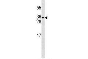 PDGFC antibody western blot analysis in MDA-MB231 lysate. (PDGFC antibody  (AA 74-103))