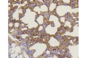 Immunohistochemistry of paraffin-embedded mouse lung using BAK1 antibody (ABIN5996915) at dilution of 1/100 (40x lens).