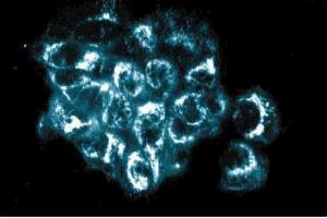 Immunofluorescence staining of A431 cells (Human epithelial carcinoma, ATCC CRL-1555). (AKAP1 antibody  (AA 66-212))