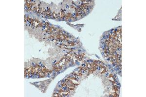 Immunohistochemistry of paraffin-embedded mouse testis using CHMP2B Rabbit mAb (ABIN7266290) at dilution of 1:100 (40x lens). (CHMP2B antibody)