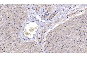 Detection of PRDX3 in Human Liver Tissue using Polyclonal Antibody to Peroxiredoxin 3 (PRDX3) (Peroxiredoxin 3 antibody  (AA 5-233))