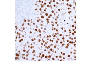 Immunohistochemistry (IHC) image for anti-Tumor Protein P53 Binding Protein 1 (TP53BP1) (AA 350-400) antibody (ABIN7455070) (Recombinant TP53BP1 antibody  (AA 350-400))