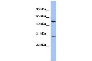 Cytokeratin 75 antibody used at 1 ug/ml to detect target protein. (Keratin 75 antibody  (N-Term))