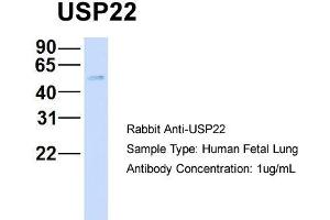 Host: Rabbit   Target Name: USP22   Sample Tissue: Human Fetal Lung  Antibody Dilution: 1. (USP22 antibody  (Middle Region))