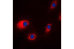 Immunofluorescent analysis of CLCN7 staining in HeLa cells. (CLCN7 antibody  (N-Term))