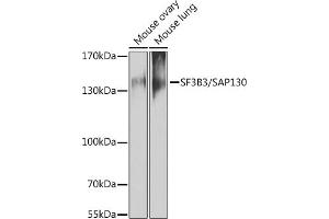 Western blot analysis of extracts of various cell lines, using SF3B3/S antibody (ABIN6128696, ABIN6147668, ABIN6147669 and ABIN6221751) at 1:1000 dilution. (SF3B3 antibody  (AA 948-1217))
