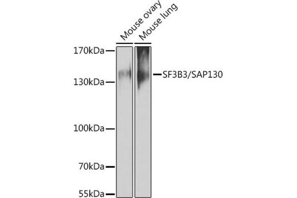 SF3B3 anticorps  (AA 948-1217)