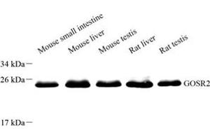 Western blot analysis of Membrin (ABIN7074118) at dilution of 1: 8000 (GOSR2 antibody)