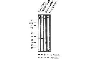 Western blot analysis of Phospho-DARPP-32 (Thr34) expression in various lysates (DARPP32 antibody  (pThr34))