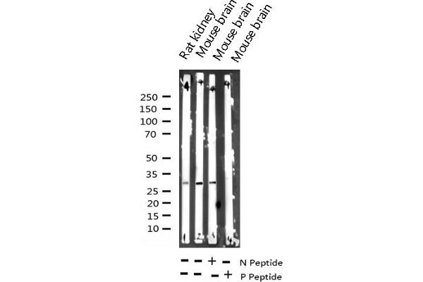 DARPP32 antibody  (pThr34)