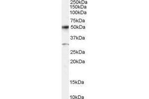 ABIN2561259 staining (0. (ATF2 antibody  (C-Term))
