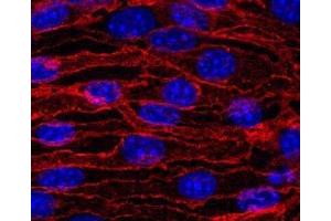 Figure 1. (Cadherin 5 antibody)