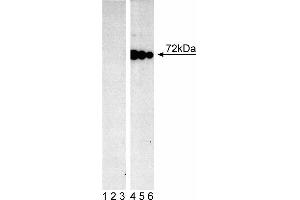 Lysate from control (First Panel) and pervanadate-treated (Second Panel) Ramos cells (Burkitt's lymphoma) were probed with mAb I120-722 at concentrations of 0. (SYK antibody  (pTyr348))