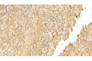 Immunohistochemistry (IHC) image for anti-Keratin 18 (KRT18) (AA 238-396) antibody (ABIN7426868)