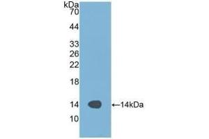 Detection of Recombinant ALT, Human using Polyclonal Antibody to Alanine Aminotransferase (ALT) (ALT antibody  (AA 367-480))