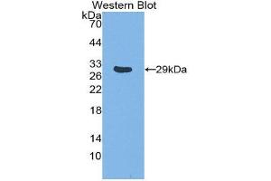 Western Blotting (WB) image for anti-TNF Receptor-Associated Factor 1 (TRAF1) (AA 169-392) antibody (ABIN3203445)