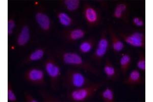 Immunofluorescence staining of methanol-fixed HeLa cells using MEF2A (phospho T312) polyclonal antibody . (MEF2A antibody  (pThr312))