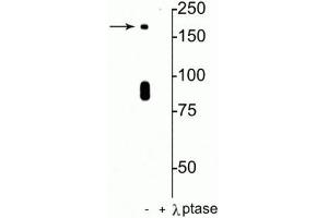 Western blot of rat hippocampal lysate showing specific immunolabeling of the ~180 kDa NR2B subunit of the NMDAR phosphorylated at in the first lane (-). (GRIN2B antibody  (pSer1480))