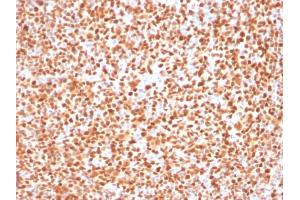 Formalin-fixed, paraffin-embedded human Tonsil stained with Oct-2 Mouse Monoclonal Antibody (OCT2/2137).