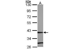 WB Image Sample (30 ug of whole cell lysate) A: Hep G2 , 10% SDS PAGE antibody diluted at 1:5000 (ZNF707 antibody)