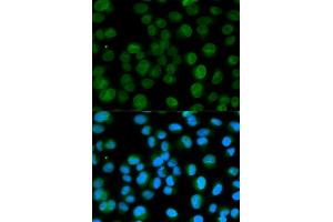 Immunofluorescence analysis of HeLa cell using EMD antibody. (Emerin antibody)