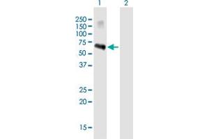 Western Blot analysis of ZSCAN5A expression in transfected 293T cell line ( H00079149-T01 ) by ZSCAN5A MaxPab polyclonal antibody. (ZSCAN5A antibody  (AA 1-496))