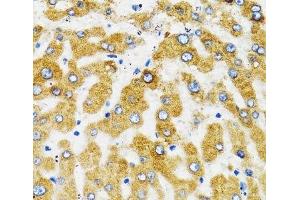 Immunohistochemistry of paraffin-embedded Human liver using SLC27A2 Polyclonal Antibody at dilution of 1:100 (40x lens). (SLC27A2 antibody)
