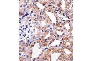 Immunohistochemical analysis of paraffin-embedded M. (RPS6 antibody)