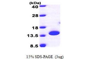 SDS-PAGE (SDS) image for Peptidyl-tRNA Hydrolase 2 (PTRH2) (AA 64-179) protein (His tag) (ABIN667850) (PTRH2 Protein (AA 64-179) (His tag))