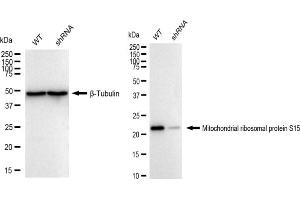 Western blotting analysis using Mitochondrial ribosomal protein S15 antibody (ABIN7799432).