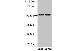 Western blot All lanes: PAH antibody at 2. (Phenylalanine Hydroxylase antibody  (AA 2-452))