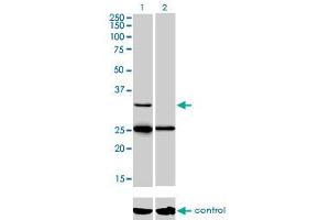 Western blot analysis of STAR over-expressed 293 cell line, cotransfected with STAR Validated Chimera RNAi (Lane 2) or non-transfected control (Lane 1). (STAR antibody  (AA 81-180))