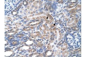 SLC29A2 antibody was used for immunohistochemistry at a concentration of 4-8 ug/ml. (SLC29A2 antibody)