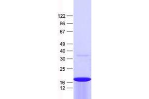 Western Blotting (WB) image for ZFP69 Zinc Finger Protein (ZFP69) protein (His tag) (ABIN2736106)