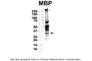 IP Suggested Anti-MBP Antibody Positive Control: NT2 CELL/BRAIN TISSUE (MBP antibody  (Middle Region))