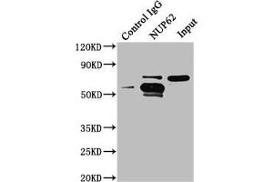 Immunoprecipitating NUP62 in A549 whole cell lysate Lane 1: Rabbit control IgG instead of ABIN7161836 in A549 whole cell lysate. (NUP62 antibody  (AA 173-522))