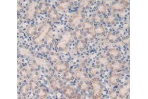 Figure. (GLO1 antibody  (AA 7-182))