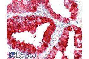ABIN5539546 (5µg/ml) staining of paraffin embedded Human Prostate. (Kallikrein 6 antibody  (Internal Region))