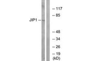 Western blot analysis of extracts from COLO205 cells, treated with Serum 20% 15', using JIP1 (Ab-103) Antibody. (MAPK8IP1 antibody  (AA 69-118))