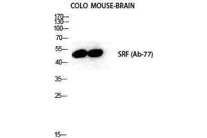 Western Blotting (WB) image for anti-Serum Response Factor (SRF) (Tyr1197) antibody (ABIN3180896) (SRF antibody  (Tyr1197))