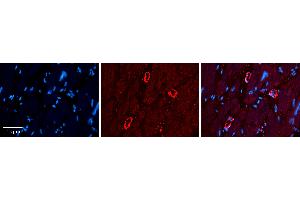 Rabbit Anti-GRP78 Antibody   Formalin Fixed Paraffin Embedded Tissue: Human heart Tissue Observed Staining: Cytoplasmic Primary Antibody Concentration: 1:100 Other Working Concentrations: 1:600 Secondary Antibody: Donkey anti-Rabbit-Cy3 Secondary Antibody Concentration: 1:200 Magnification: 20X Exposure Time: 0. (GRP78 antibody  (C-Term))