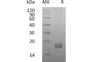 Chemokine (C-C Motif) Ligand 24 (CCL24) protein (His tag)