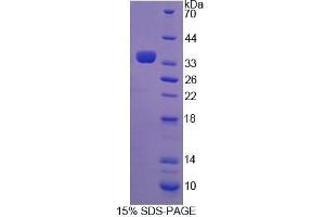 SDS-PAGE (SDS) image for Transglutaminase 3 (E Polypeptide, Protein-Glutamine-gamma-Glutamyltransferase) (TGM3) (AA 468-693) protein (His tag) (ABIN1081017)