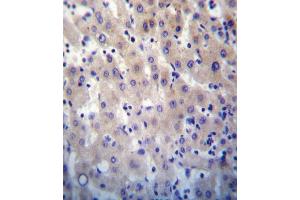HPRT1 Antibody (N-term) (ABIN652234 and ABIN2840981) immunohistochemistry analysis in formalin fixed and paraffin embedded human liver tissue followed by peroxidase conjugation of the secondary antibody and DAB staining.