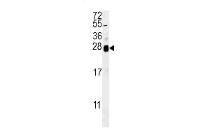 Western blot analysis in A2058 cell line lysates (35ug/lane). (RNF114 antibody  (C-Term))