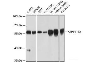 Western blot analysis of extracts of various cell lines using ATP6V1B2 Polyclonal Antibody at dilution of 1:1000. (ATP6V1B2 antibody)