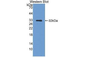 Detection of recombinant SPR using Polyclonal Antibody to Sepiapterin Reductase (SPR) (SPR antibody  (AA 1-261))