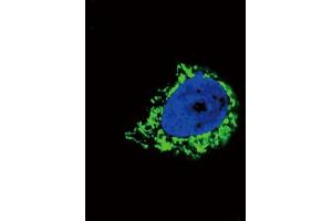 Immunofluorescence (IF) image for anti-Insulin-Like Growth Factor Binding Protein 2, 36kDa (IGFBP2) antibody (ABIN3003819)