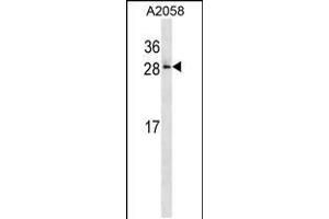 Western blot analysis in A2058 cell line lysates (35ug/lane). (RAB28 antibody  (AA 119-147))