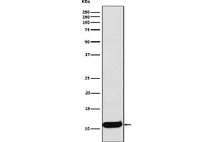 Western blot analysis of CCL19 expression in Human Macrophage Inflammatory Protein 3 beta recombinant protein lysate.